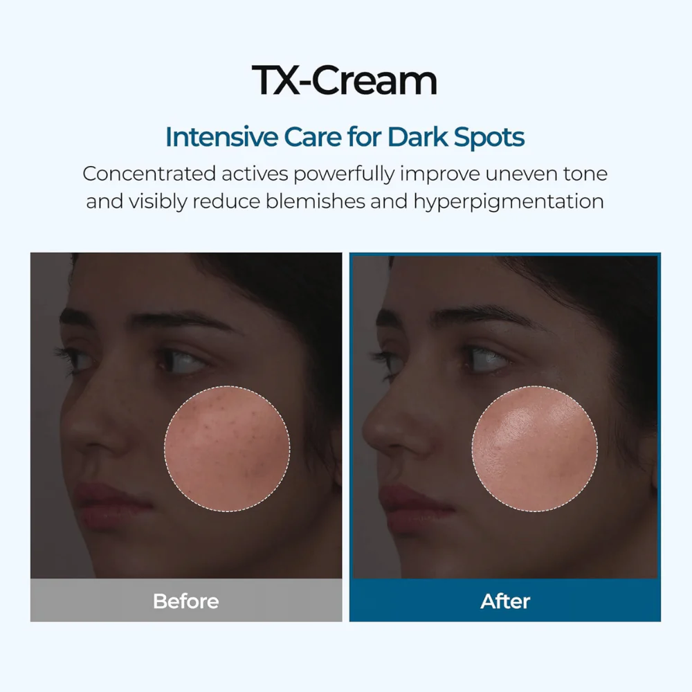 TX Cream 50ml - Image 2
